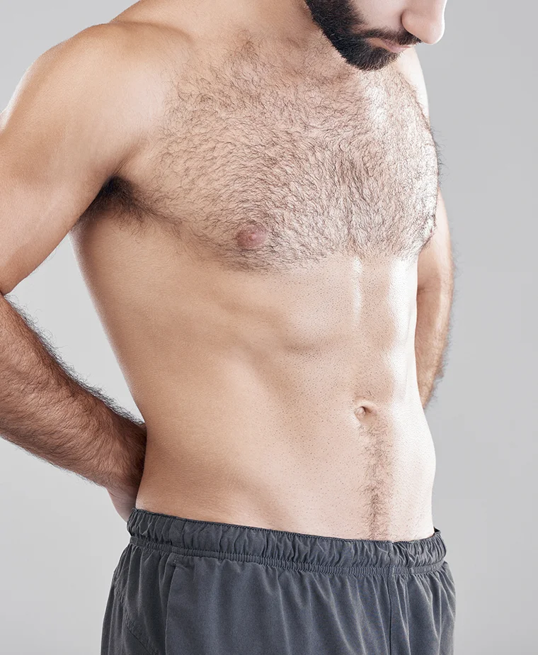 Abdominoplastie pour remodeler la silhouette