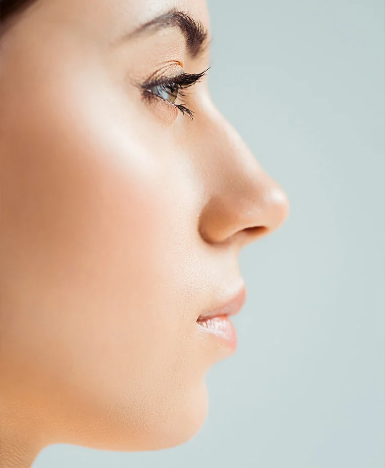 Correction d'une bosse nasale par rhinoplastie
