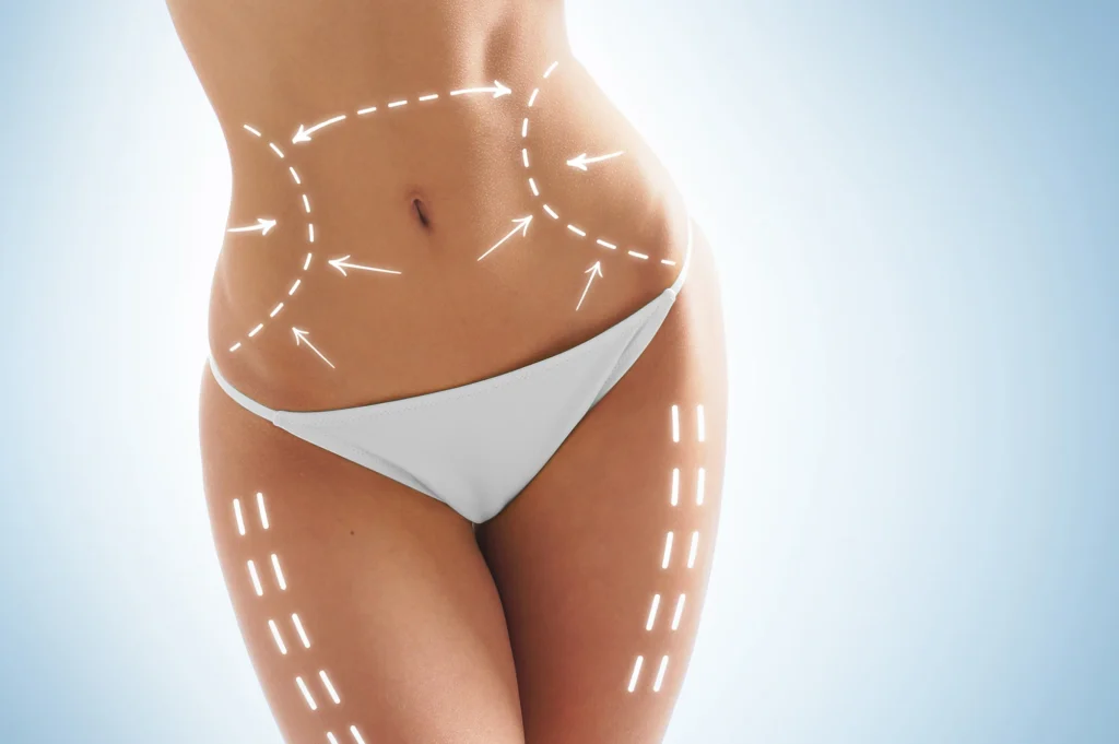 Chirurgie esthétique de la silhouette à Toulouse en Haute-Garonne
