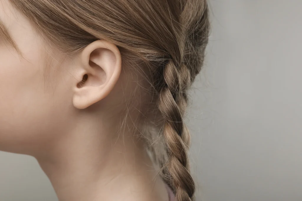 Chirurgie des oreilles décollées par otoplastie