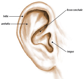 Schéma Otoplastie des oreilles décollées