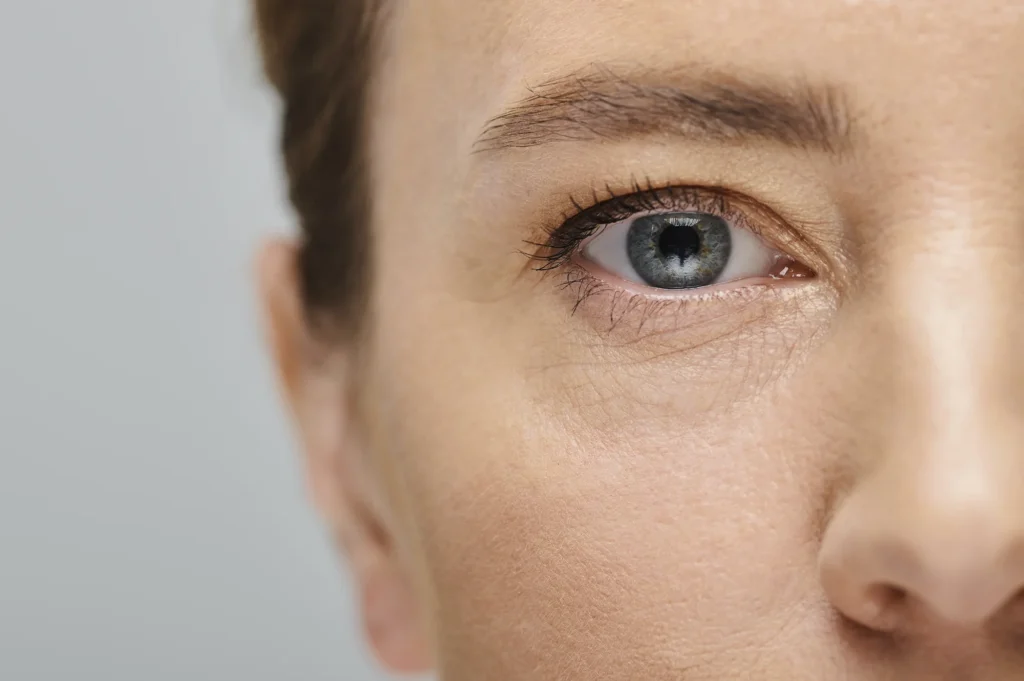 Blépharoplastie et chirurgie esthétique du contour des yeux