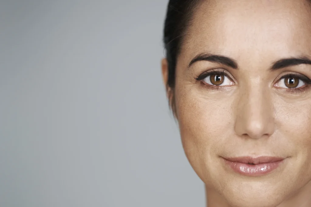 Injection de toxine botulique Botox en médecine esthétique